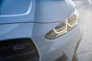 20代のM字ハゲを改善する方法は？