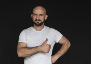 若ハゲは遺伝による確率がどれくらいあるのか？