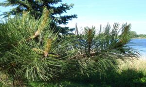 AGAは遺伝だけで決まるわけではないのか？